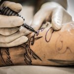 Laserbehandeling voor tattoo weglaseren bij een gespecialiseerde huidkliniek met geavanceerde apparatuur
